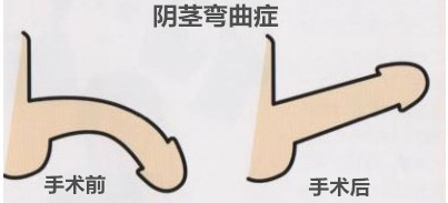 ôжҪ